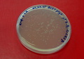 Płytka agarowa z bakteriami E.coli